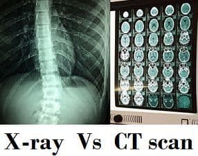 Difference Between X Ray And Ct Scan With Comparison Chart Bio Differences