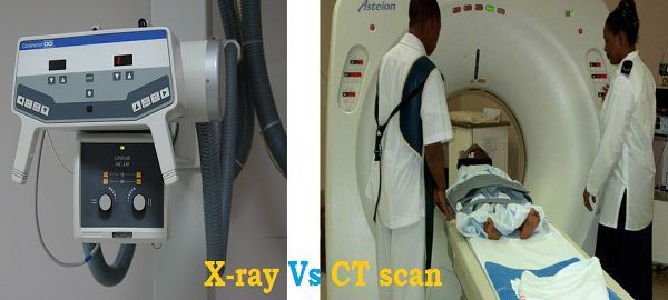 Ct Scanner Comparison Chart