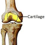 cartilage