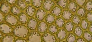 Difference Between Parenchyma Collenchyma; and Sclerenchyma Cells (with